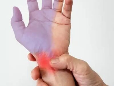 The Digital Ache: Navigating Carpal Tunnel Syndrome