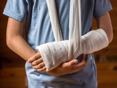 When a Bone Breaks: Simple Guide to Fractures and How We Treat Them